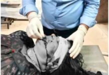 अजमेर में शराब के लिए पैसे नहीं देने पर बेटे ने मां पर किया चाकू से हमला, गाल पर 15 टांके।