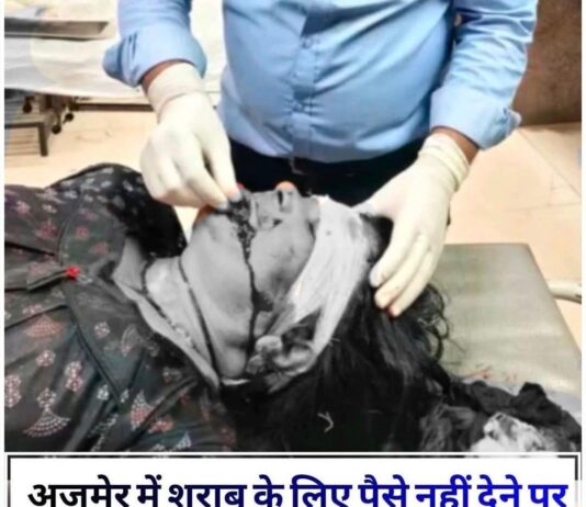 अजमेर में शराब के लिए पैसे नहीं देने पर बेटे ने मां पर किया चाकू से हमला, गाल पर 15 टांके।